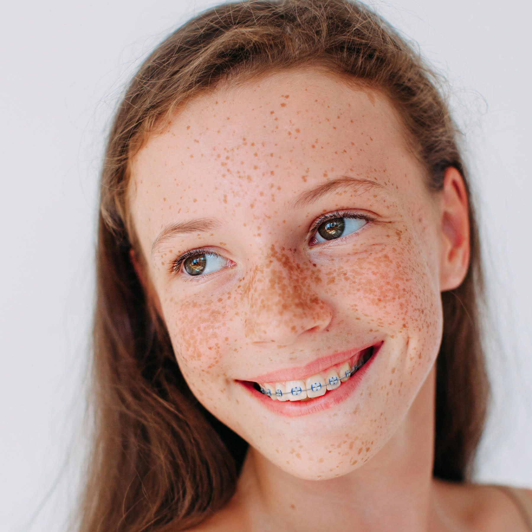 Young female orthodontic patient in Irvine smiling while wearing custom clear braces