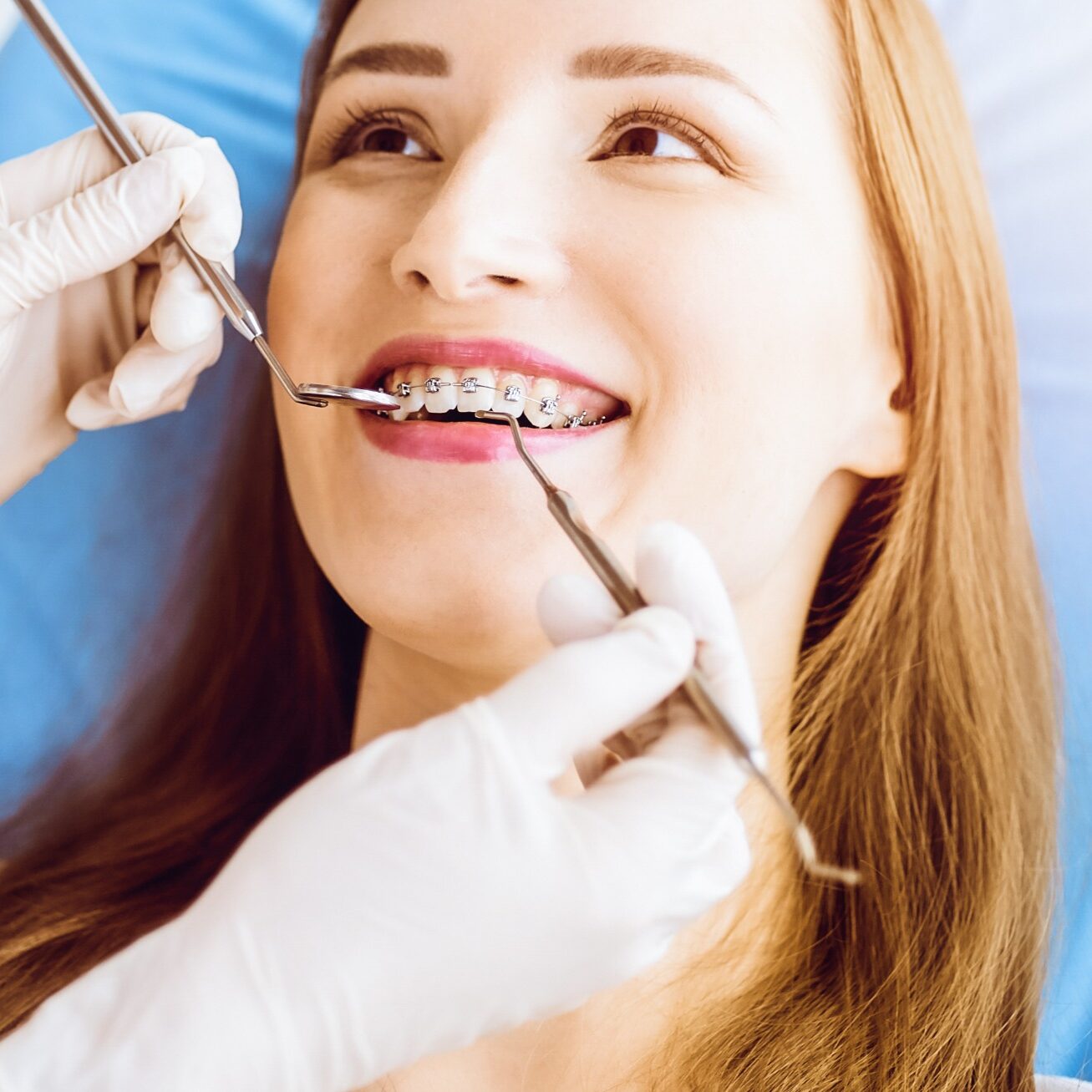 orthodontist irvine ca